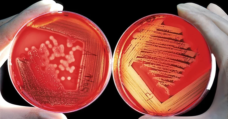 Gélatine ou agar-agar : le seul tableau qui compte vraiment